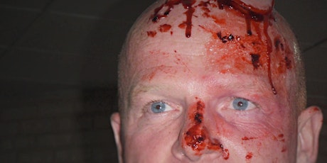 MOULAGE: The Art of Creating Simulated Wounds primary image