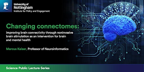 Changing connectomes: improving brain connectivity billets