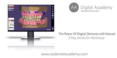 The Power of Digital Dentures with Exocad