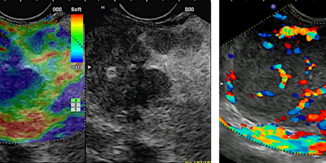 Image-guided treatment of pancreaticobiliary tumours primary image