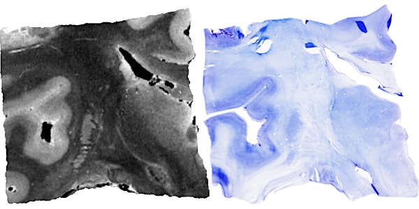 Workshop on Digital Histology Reconstruction