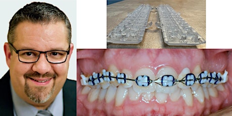 Dr. Thomas Shipley:  "3D Printing - The Next Big Adventure in Orthodontics"