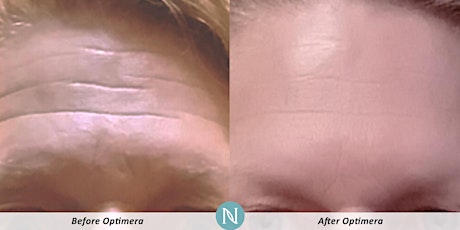 Nerium Real Results Skin Care for the Spa!