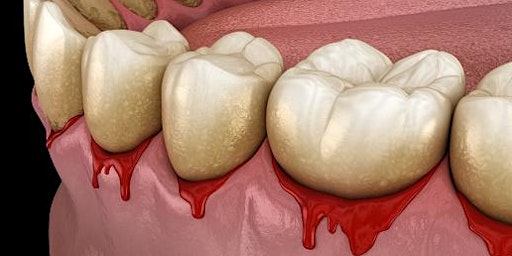 Level UP your Periodontal Care