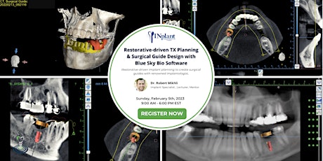 Restorative-driven TX Planning & Surgical Guide Design with BlueSky Bio S/W