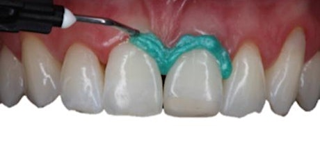 Imagem principal do evento Workshop - Clareamento Dental