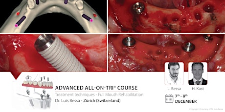 Advanced All-on-TRI® Course