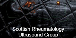 Scottish Rheumatology Ultrasound Group - Sonography Course December 2022
