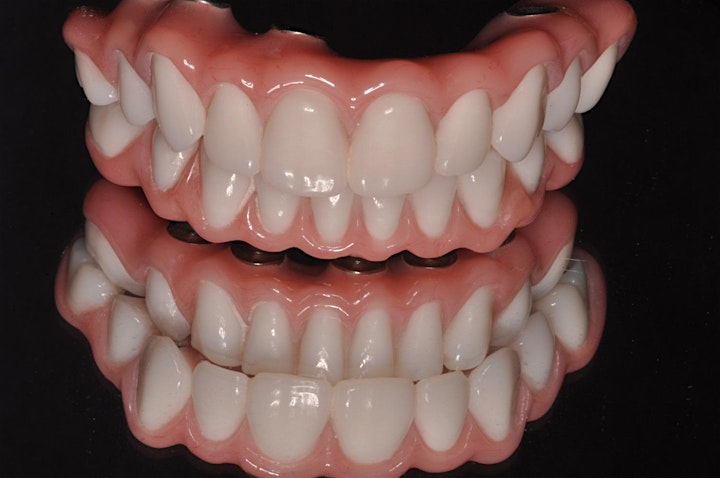 New Course:  Immediate Full Arch Implant Reconstruction image