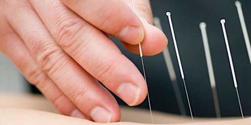 How Acupuncture can help you