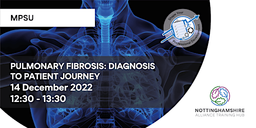 Pulmonary Fibrosis: Diagnosis to the Patient Journey