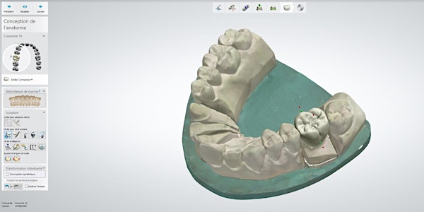 Formations dentaire KREOS 2023 - Dental System Niveau 1