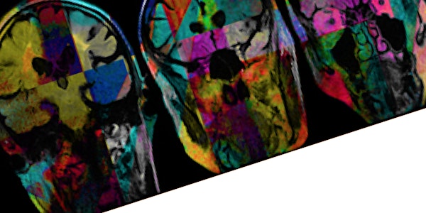 Cambridge Neurological Society Annual Symposium - Towards personalised neurology: from studying neurons to treating individuals