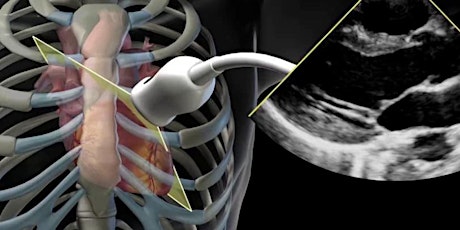 Hauptbild für Critical Care Echocardiography Course (TTE) March-May 2023