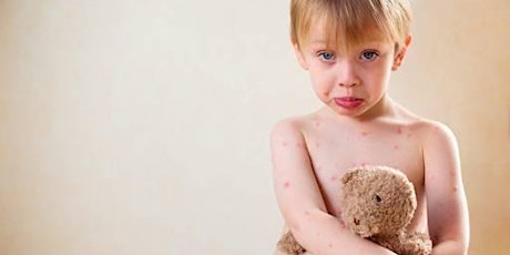 Skin Rashes in Children:  A Guide for Anxious Moms primary image