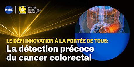 Webinaire d'information (français): Détection précoce du cancer colorectal