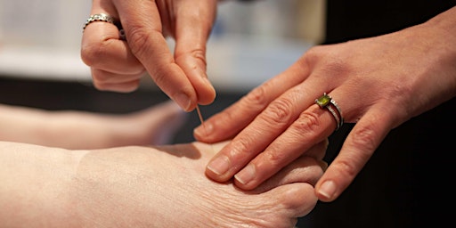 Become an Acupuncturist - ICOM Open Day (online)