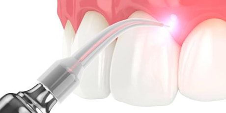 Lasers in Dentistry—Come and See the Light