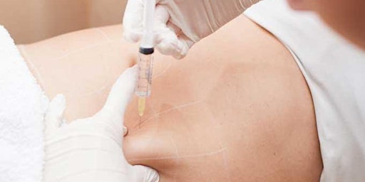 Mesotherapy Training - LiveStream/Online Training primary image