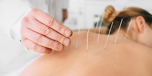 Acupuncture primary image