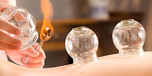 Fire Cupping primary image