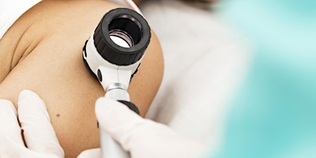 The Donna Annand Melanoma Charity Mole Clinic primary image