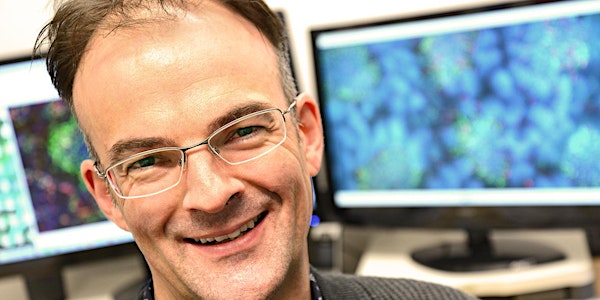 Prions: ninja pathogens and immune system hijackers