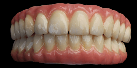 Success with Pearl Screw-Retained Zirconia Hybrid Bridge primary image