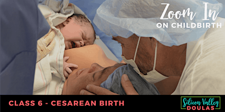 Zoom in on Childbirth - Class 6: Cesarean Birth primary image