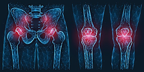 FREE PATIENT SEMINAR: Total Hip and Knee Replacement Surgery primary image