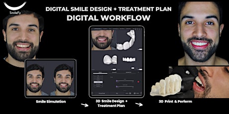 Smile Design Hands-on Course:  Learn 3D Facially-Guided Mockups Designs