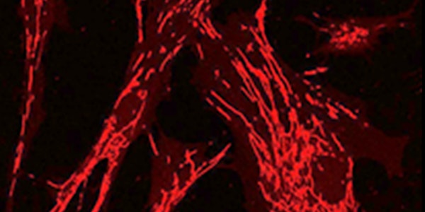 13th International Workshop on Cardiovascular Biology and Translational Med...