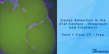 Caries Detection in the 21st Century - Diagnosis and Treatment primary image