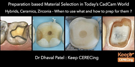 Preparation Based Material Selection in Today's CEREC World