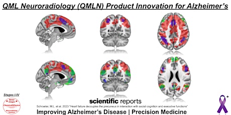 QML Neuroradiology (QMLN) Product Innovation for Alzheimer’s