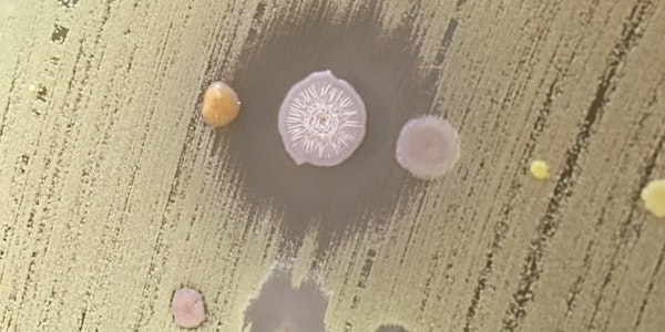 Integrating knowledge and approaches across microbiomes: from plants to hum...