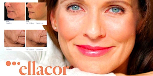 Ellacor VIP event!  The new non-surgical alternative to a facelift.