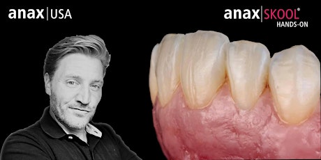 Gingival Form, Texture and Replication in anaxgum w/ Florian Steinheber