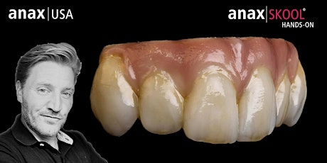 Gingival Micro-Layering in Soprano Surface w/ Florian Steinheber