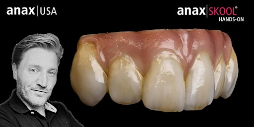 Gingival Micro-Layering in Soprano Surface w/ Florian Steinheber primary image