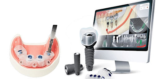 Perfect Placement Digitally Guided Dental Implant System | Lakewood Co