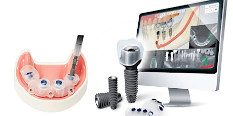 Perfect Placement Digitally Guided Dental Implant System | Laurel, MD