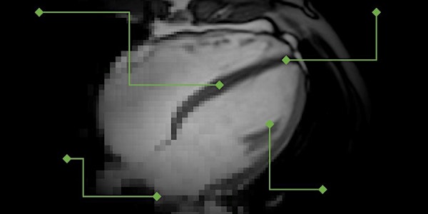 Introduction to Cardiac MRI for Radiographers
