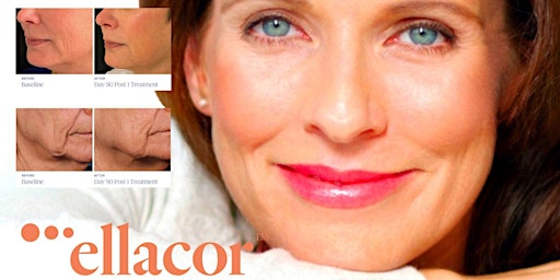 Ellacor VIP event!  The new non-surgical alternative to a facelift.