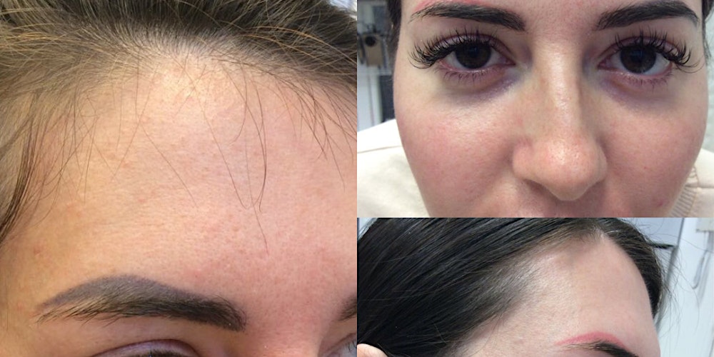 Eyebrow Ink Tattoo Removal with Picosure Tattoo Removal Laser at Laseryou  Tickets, Mon 27 Feb 2023 at 09:00 | Eventbrite
