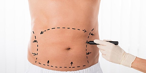 Free Consultation For Tummy Tuck at Bellevue With Dr. Allegra