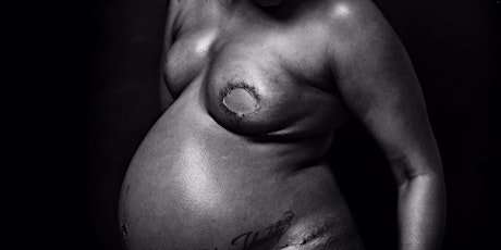 Black Women Heal . . . Life, Love & Sex after Mastectomy 