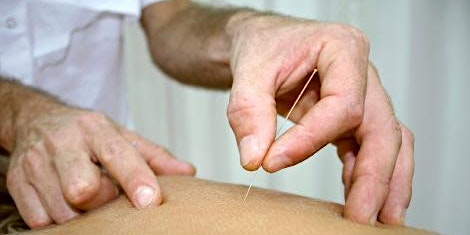 Introduction to Dry Needling - CPD primary image