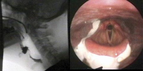 Rating Instrumental Swallowing Assessments primary image