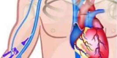 IMPIANTO PICC e MIDLINE IMPIANTO PICC e MIDLINE